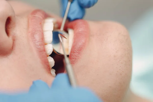 歯だ。歯科医院だ。医者と患者だ。歯の健康. — ストック写真
