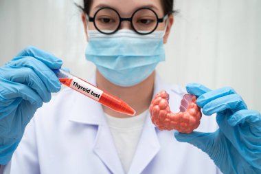 Doktor tiroid bezi modeli ve kan örneği tüpünü laboratuarda tutuyor..