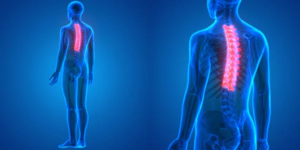 Illustratie Van Ziekte Van Human Spinal Cord — Stockfoto