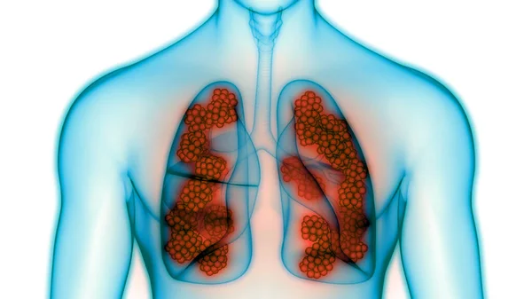 Sistema Respiratorio Umano Polmoni Con Anatomia Alveoli — Foto Stock