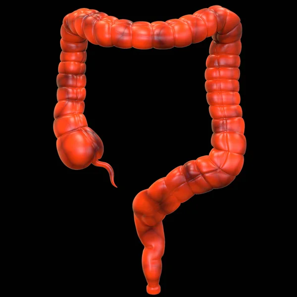 Menselijk Spijsverteringsstelsel Grote Intestine Anatomie — Stockfoto