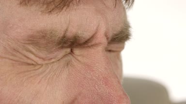 ortak göz enfeksiyonu ve inflamnmation, adam damlama tedavi bırakır. 4k