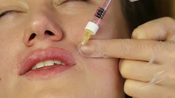 Lábio Aumento em uma clínica. médico fazendo injeção de botox nos lábios. câmara lenta — Vídeo de Stock