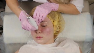 young woman with problem skin, mechanical deep face cleaning. beautician cleanses the womans skin with cosmetic equipment