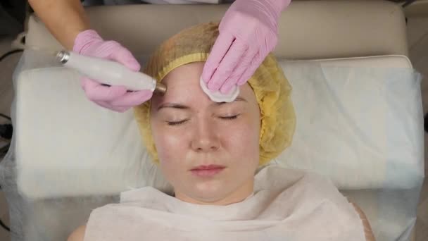 Young woman with problem skin, mechanical deep face cleaning. beautician cleanses the womans skin with cosmetic equipment — Stockvideo