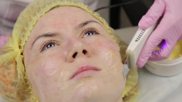 Esteticista en el trabajo. Procedimiento ultrasónico de limpieza facial para la piel problemática. Limpieza de poros, saturación de oxígeno para la cara de las mujeres — Vídeos de Stock