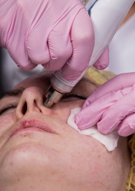 young woman with problem skin, mechanical deep face cleaning. beautician cleanses the womans skin with cosmetic equipment