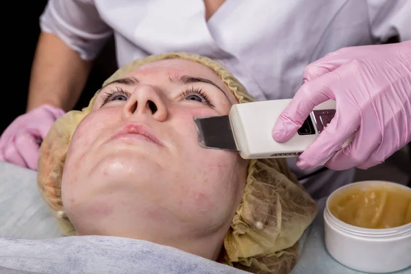Esthéticienne au travail. Procédure de nettoyage du visage par ultrasons pour les peaux à problèmes. Nettoyage des pores, saturation en oxygène pour le visage des femmes — Photo