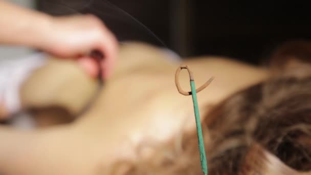 Masseur maakt acupressuur op een vrouwelijke rug. Wierookstokjes branden, blauwe rook langzaam stroomt. Chinese alternatieve geneeskunde. — Stockvideo