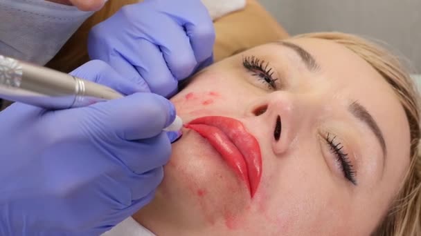 Tratamiento labial de primer plano. procedimiento de maquillaje permanente para los labios del cliente femenino — Vídeo de stock