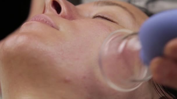 Kosmetikerin führt Anti-Aging-Massage mit Vakuumbänken durch. Vakuum-Gesichtsmassage zur Regeneration der Haut — Stockvideo