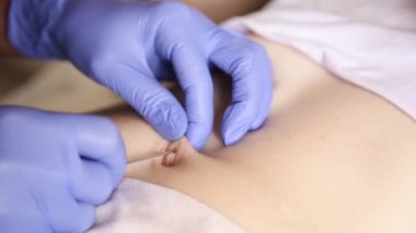Göbek piercing yüklemek için işlem. Doktor ponksiyon göbek yapıyor