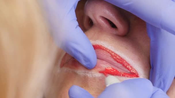 Tratamiento labial de primer plano. procedimiento de maquillaje permanente para los labios del cliente femenino — Vídeo de stock