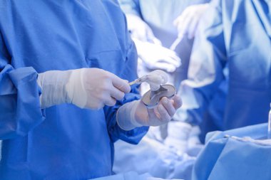 Steril ameliyat odasındaki diz implantına kemik çimentosu uygulayan bir cerrah tıbbî eğitim ve cihaz pazarlaması için idealdir.