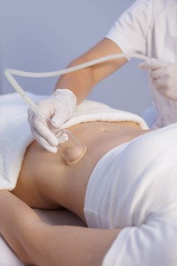 Eldivenli terapist karın bölgesine vücut terapisi için vakum bardağı uyguluyor. Parlak bir klinikte vücut geliştirme, drenaj ve cilt sağlamlaştırma amaçlı..