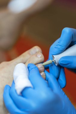 Pedikür portre. kütikül kaldırma. Profesyonel donanım Pedikür elektrik makine kullanarak. Ayak hastalıkları uzmanı ziyaret hastaya tıbbi pedikür yordamı,