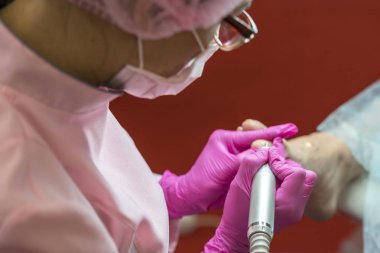 Podiatry doktor. Ayak ve tırnak tedavisi. Profesyonel donanım Pedikür elektrik makine kullanarak. Hastanın tıbbi pedikür usulü hakkında.