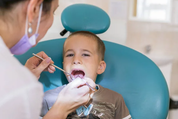 歯科診療所における少年の歯を調べること 歯科用椅子笑顔で小さな患者 Dantist 歯を扱います 歯科医歯科医のオフィスで小さな男の子の歯の治療のクローズ アップ表示 — ストック写真