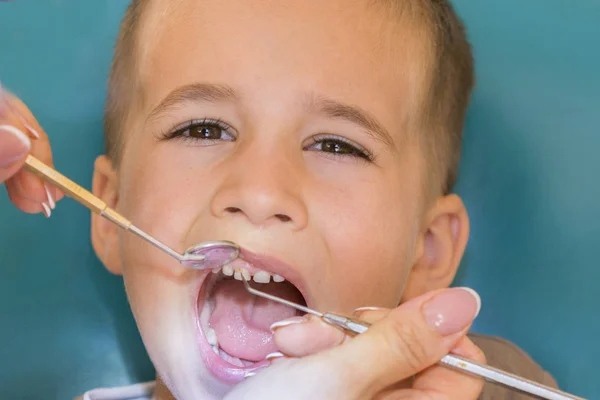 歯科医の診療所で小さな男の子の歯を調べること 彼の歯は 歯科医によって検討を持つ少年のクローズ アップ 歯科医院の子 医師に — ストック写真