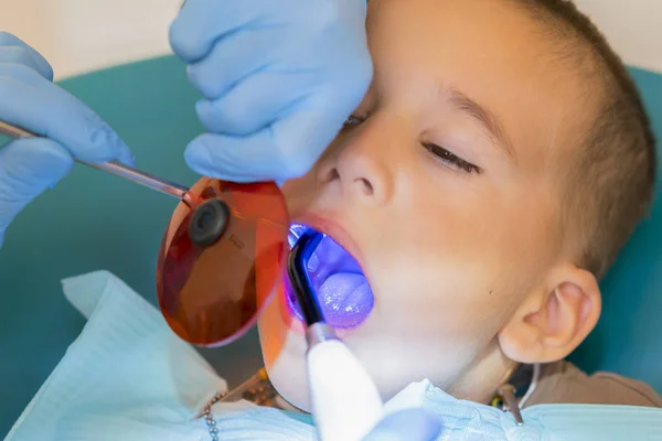 Dentist examining boy\'s teeth in clinic. A small patient in the dental chair smiles. Dantist treats teeth. close up view of dentist treating teeth of little boy in dentist office
