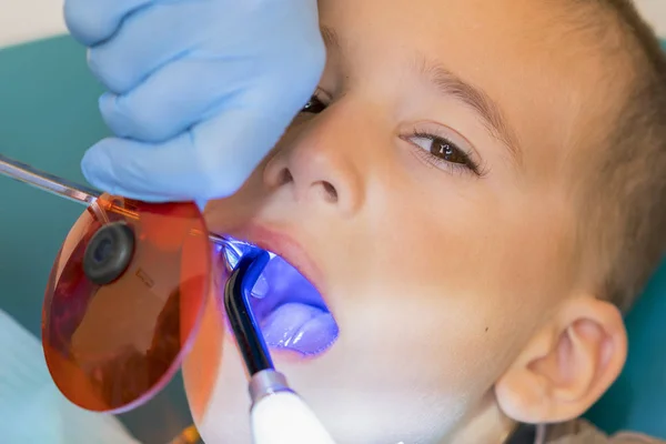 Dentist examining boy's teeth in clinic. A small patient in the dental chair smiles. Dantist treats teeth. close up view of dentist treating teeth of little boy in dentist office