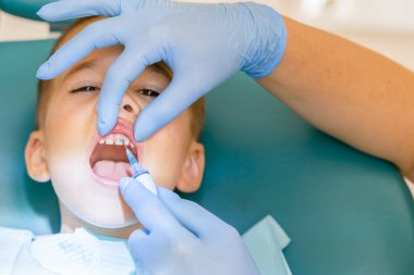 Çocuk Diş Kliniği inceleyerek dişçi. Küçük bir hastada diş sandalye gülümsüyor. Dantist diş davranır. diş hekimi diş dişçi ofisinde küçük çocuk tedavi görünümünü kapat.