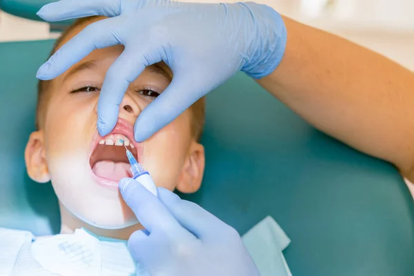 Dentist examining boy\'s teeth in clinic. A small patient in the dental chair smiles. Dantist treats teeth. close up view of dentist treating teeth of little boy in dentist office.