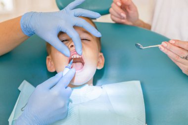 Diş hekimi bir çocuğun diş tedavi ediyor. Çocuk Diş Hekimliği, Pediatrik Diş Hekimliği. Bir kadın stomatologist bir okul çağındaki çocuğun diş tedavi ediyor. Ağız sağlığı ve hijyen.