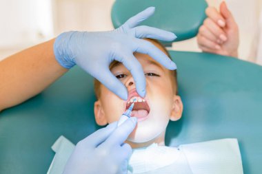 diş hekimi, çocuk. Bir diş hekimi diş küçük bir çocuğun inceliyor. dikey fotoğraf.