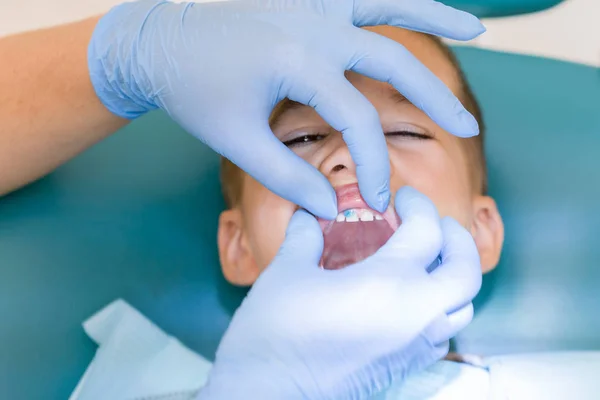 Stomatolog Dziecięcy Badając Małe Zęby Chłopców Fotelu Dentyści Klinice Stomatologicznej — Zdjęcie stockowe