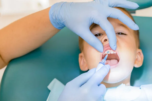 Kid Boy Dentist Chair Office Treats Teeth Doctor Child Boy — Stock Photo, Image