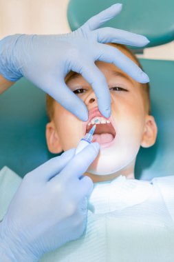 Dişçi koltuğu ofis içindeki çocuk çocuk diş davranır. Doktor ve çocuk. diş hekimi, çocuk. Bir diş hekimi diş küçük bir çocuğun inceliyor. dikey fotoğraf