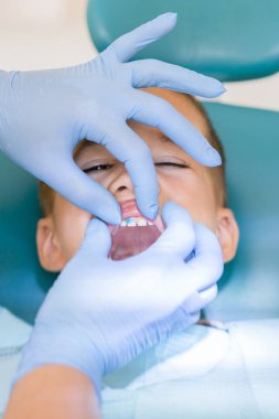 Küçük çocuk diş hekimi dişlerine bakıyor. Yakın çekim dişçi el diş çocuk hastanın klinik olarak incelenmesi. Diş hekimi diş bir çocuğun inceliyor. ertical fotoğraf