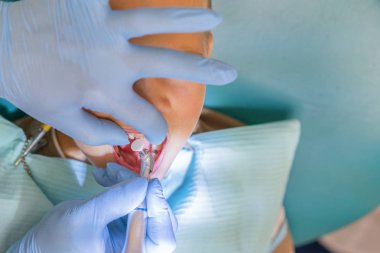 Küçük bir çocuk diş Kliniği bir dişçi resepsiyonda. Çocuk diş hekimliği, pediatrik diş hekimliği. Bir kadın stomatologist bir okul çağındaki çocuğun diş tedavi ediyor. Ağız sağlığı ve hijyen