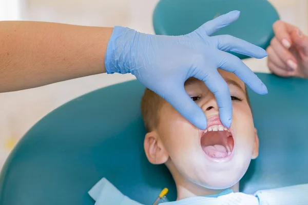 小さな男の子は 歯科で自分の歯を見ています クリニックで小児患者の歯を調べること歯科医の手のクローズ アップ 歯科医は少年の歯を調べること — ストック写真
