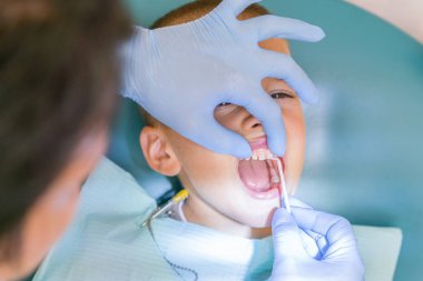 Diş hekimi bir çocuğun diş tedavi ediyor. Küçük bir hastada diş sandalye gülümsüyor. Dantist diş davranır. diş hekimi diş dişçi ofisinde küçük çocuk tedavi görünümünü kapat.