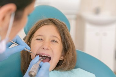 Açık ağız, diş hekimi ile genç çocuğun makro yakın çekim. Diş check-up dişçi ofisinde. Dişçi kız diş diş hekimleri sandalyede incelenmesi