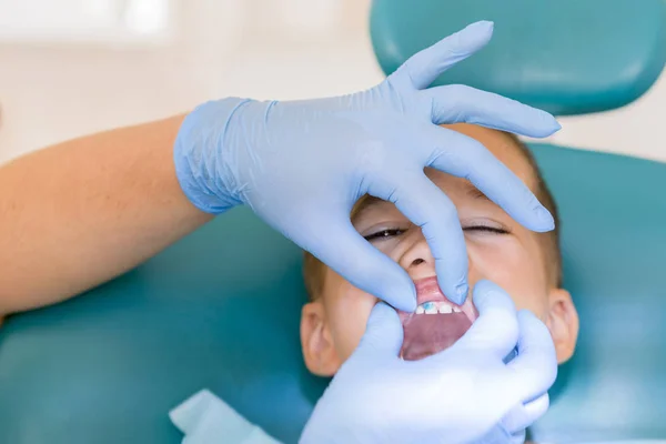 Pediatric tandläkare undersöker en liten pojkar tänder tandläkare ordförande vid tandkliniken. Tandläkaren undersöker lilla pojkens tänder i klinik — Stockfoto