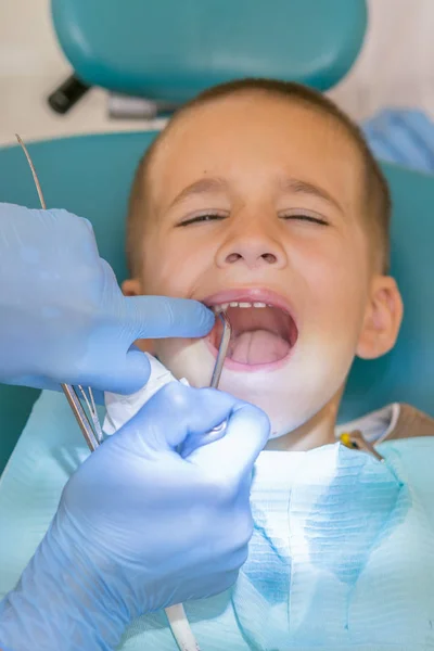 歯科診療所における少年の歯を調べること。歯科用椅子笑顔で小さな患者。Dantist は、歯を扱います。歯科医のオフィスで小さな男の子の歯の治療の歯科医のビューを閉じます。垂直写真 — ストック写真