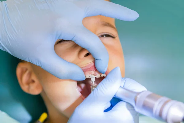 Tandläkare Behandlar Pojkes Tänder Tandläkaren Undersöker Pojkens Tänder Klinik Liten — Stockfoto