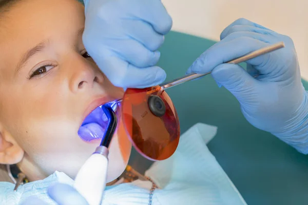 歯科診療所における少年の歯を調べること 歯科用椅子笑顔で小さな患者 Dantist 歯を扱います 歯科医歯科医のオフィスで小さな男の子の歯の治療のクローズ アップ表示 — ストック写真
