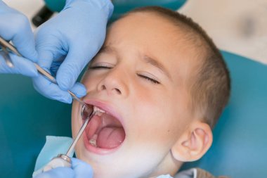 Küçük bir çocuk diş Kliniği bir dişçi resepsiyonda. Çocuk diş hekimliği, pediatrik diş hekimliği. Bir kadın stomatologist bir okul çağındaki çocuğun diş tedavi ediyor. Ağız sağlığı ve hijyen.