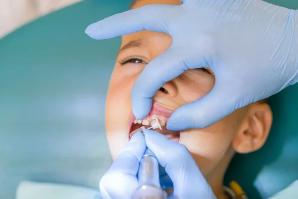 歯科医は 少年の歯を扱っています 歯科診療所における少年の歯を調べること 歯科用椅子笑顔で小さな患者 Dantist 歯を扱う — ストック写真