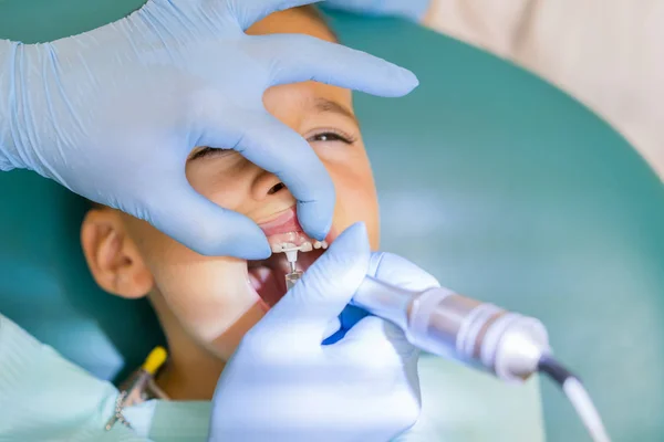 Tandläkare behandlar en pojkes tänder. Tandläkaren undersöker pojkens tänder i klinik. En liten patient i stol ler. Dantist behandlar tänder — Stockfoto