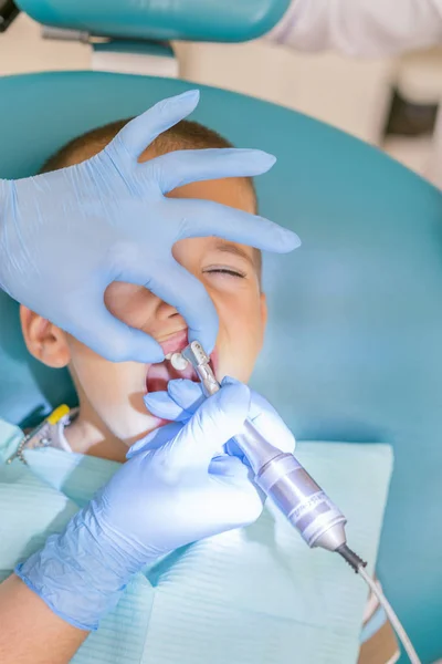 Dentysta jest leczenie zębów chłopca. Dentysta, badając chłopca zębów w klinice. Mały pacjent w uśmiechy fotela. Uczyć się u wybitnych leczy zęby. z bliska. pionowe zdjęcie — Zdjęcie stockowe