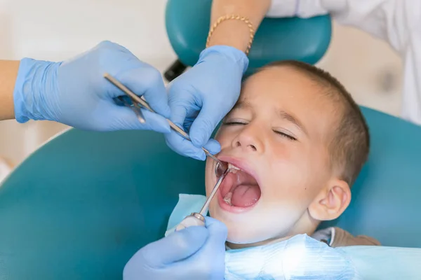 Tandläkare behandlar en pojkes tänder. Tandläkaren undersöker pojkens tänder i klinik. En liten patient i stol ler. Dantist behandlar tänder — Stockfoto