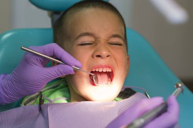 Çocuk diş hekimi diş kliniğinde diş hekimi sandalyesinde küçük bir erkek dişleri muayene. Dişçilik ofisinde dişçisi olan bir çocuk. Klinikte diş hekimi muayenesi küçük çocuğun dişleri yakın