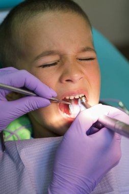 Çocuk diş hekimi diş kliniğinde diş hekimi sandalyesinde küçük bir erkek dişleri muayene. Dişçilik ofisinde dişçisi olan bir çocuk. Dişlerini diş hekimi tarafından muayene ettiren çocuğun yakın çekim