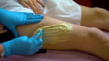 Saç çıkarma, şeker alma prosedürü..