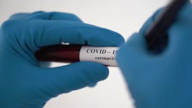 Doktorun elleri, lateks eldiven takan bir adam, kırmızı kan analizi yapılan cam tüpü tutan, Coronavirus enfeksiyonu için negatif test yapan bir adam. Sputnik V aşı örneğinin kullanılması başarılı sonuç